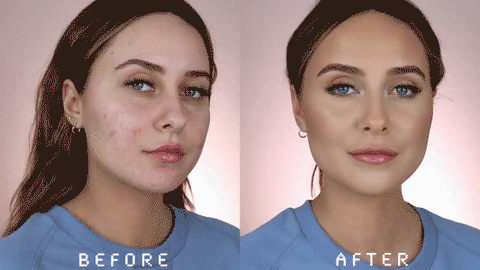ššMade and Shipped from USAāØLOVILDS⢠Bee Toxin Wrinkle Removal Cream-š„LAST DAY 70% OFF