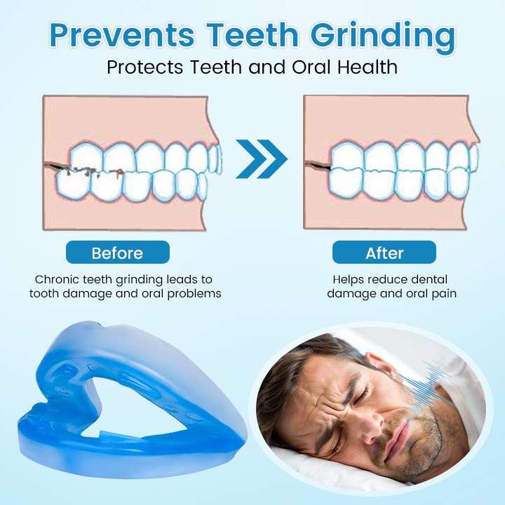 š SILENT NIGHTS, STRONG TEETH! 𦷠QIAWI⢠Anti-Snoring Guard šµāØ