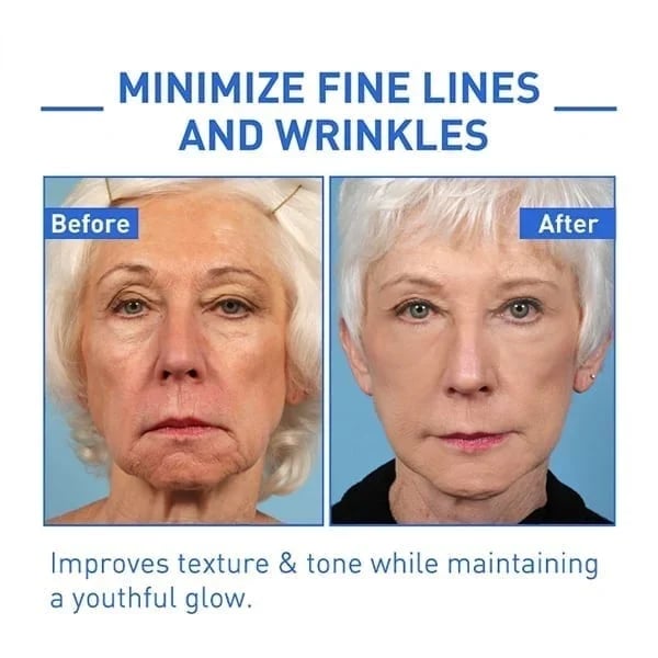 š„Limited Time Offer š„70% OFFš„ - Botox Face Serum