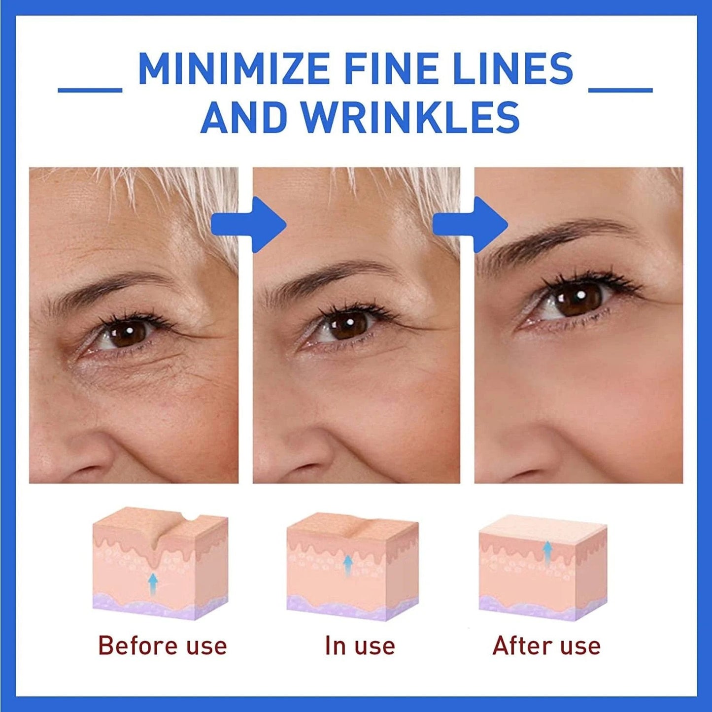š„Limited Time Offer š„70% OFFš„ - Botox Face Serum
