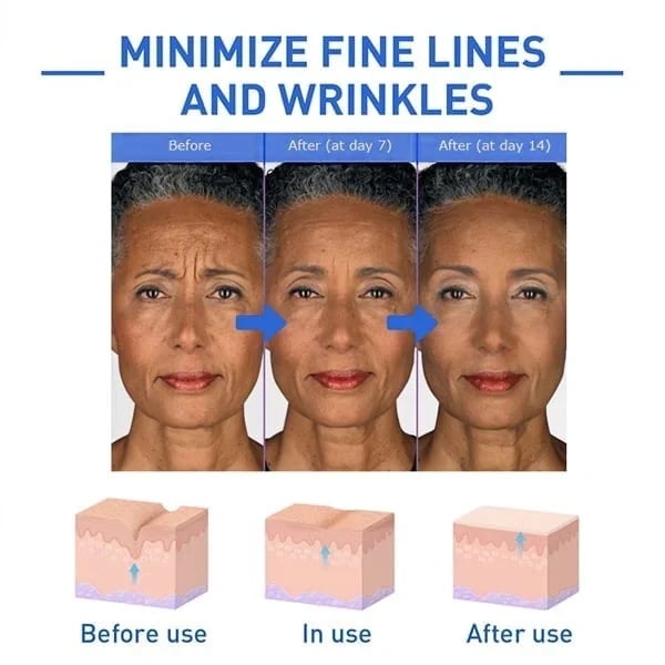 š„Limited Time Offer š„70% OFFš„ - Botox Face Serum