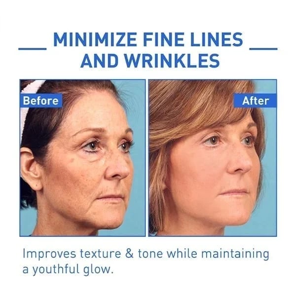 š„Limited Time Offer š„70% OFFš„ - Botox Face Serum