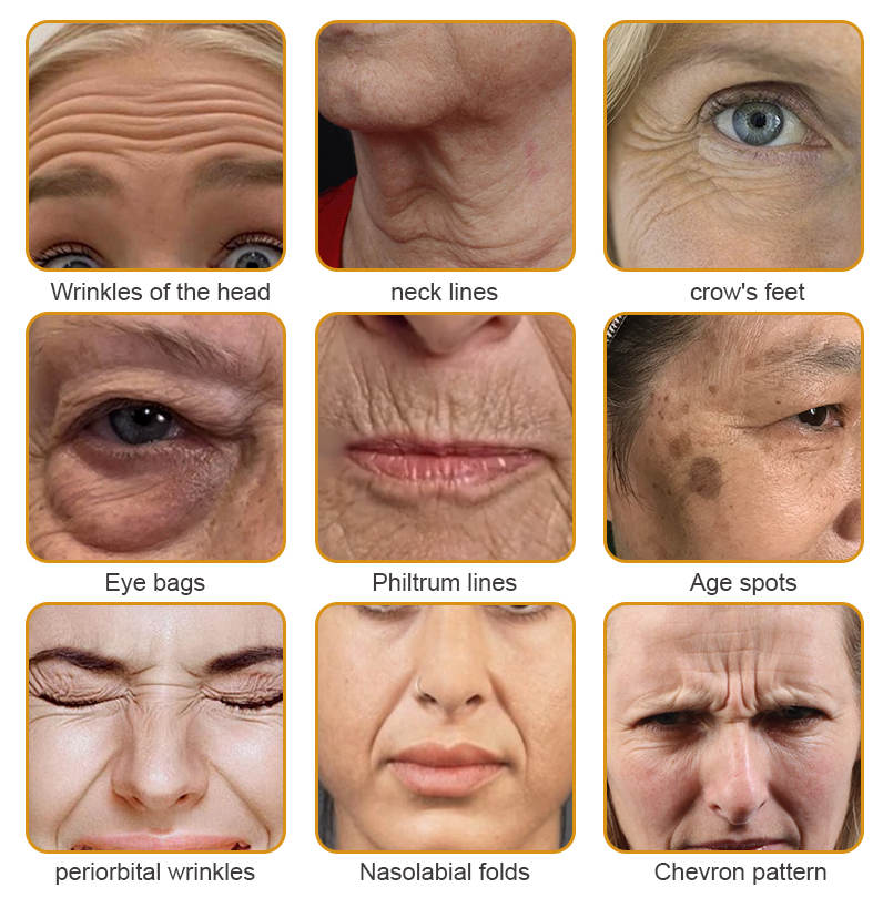 ššMade and Shipped from USAāØLOVILDS⢠Bee Toxin Wrinkle Removal Cream-š„LAST DAY 70% OFF