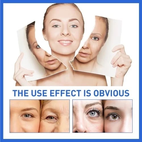 š„Limited Time Offer š„70% OFFš„ - Botox Face Serum