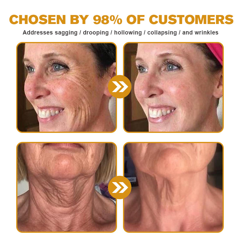 ššMade and Shipped from USAāØLOVILDS⢠Bee Toxin Wrinkle Removal Cream-š„LAST DAY 70% OFF