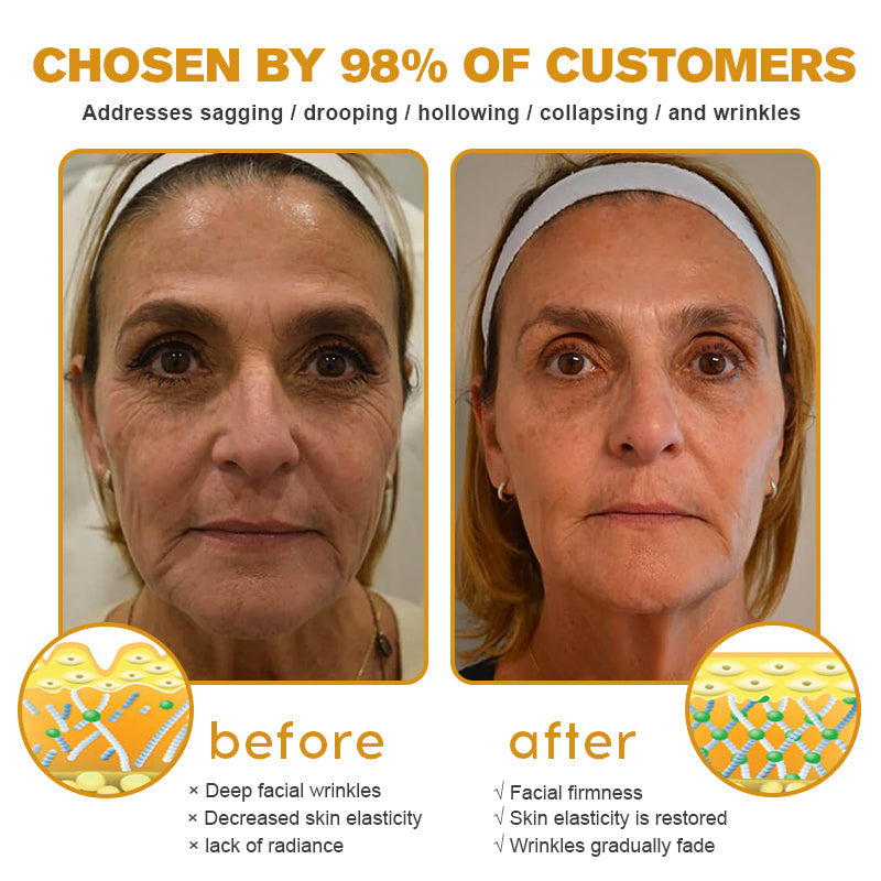 ššMade and Shipped from USAāØLOVILDS⢠Bee Toxin Wrinkle Removal Cream-š„LAST DAY 70% OFF
