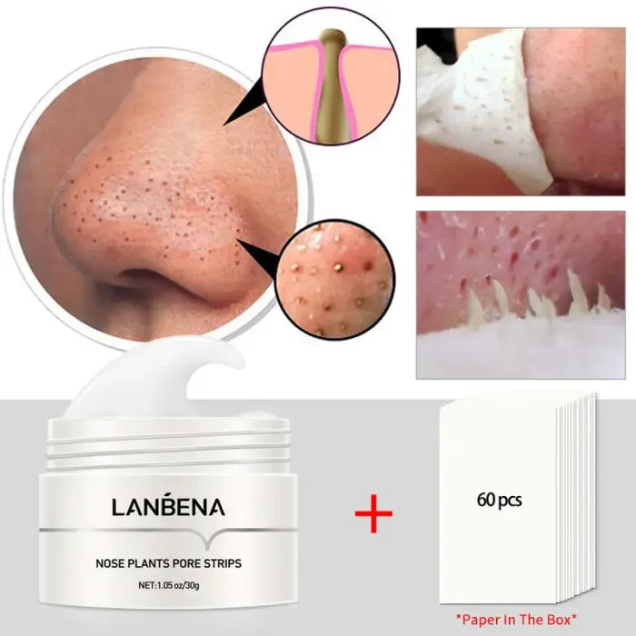 【Top Sellers】LANBENA Blackhead Pore Remover Mask