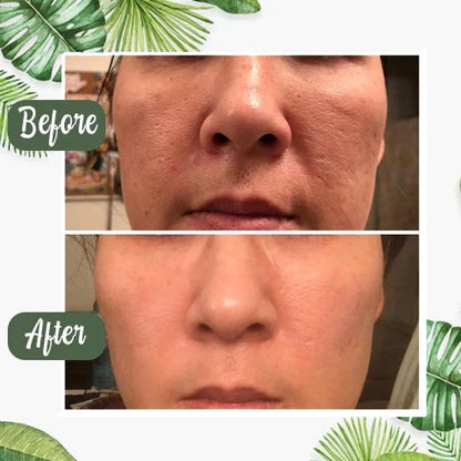 Last Day 49%OFF- ✨Green Tea Deep Cleanse Mask