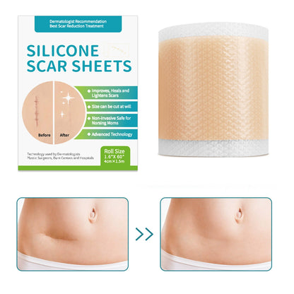 🎉Hot Sale 49% OFF🎉 - Professional Silicone Scar Sheets