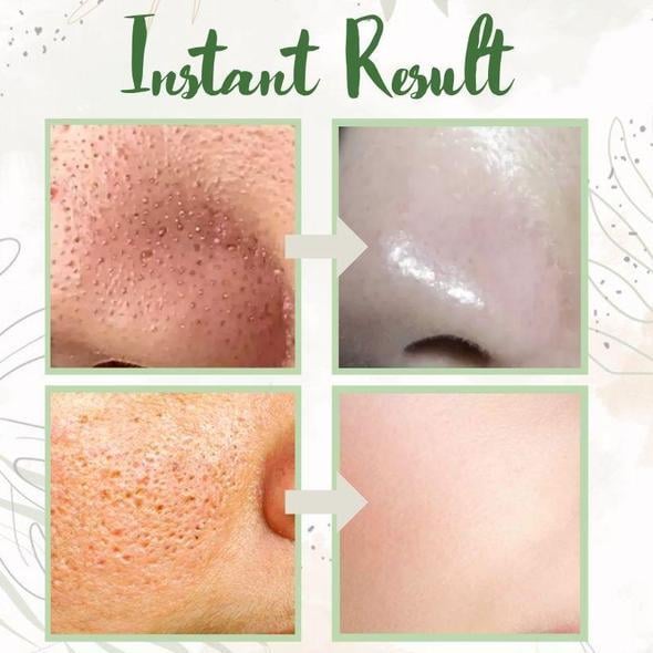 Last Day 49%OFF- ✨Green Tea Deep Cleanse Mask