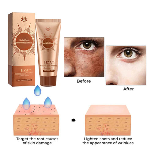 🔥[Official Brand Store] HZA™ Herbal Spots Peel-Off Facial Mask