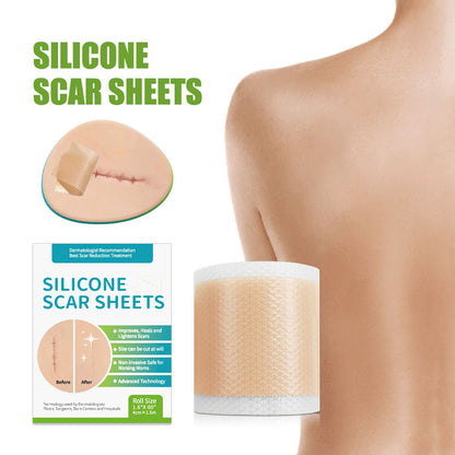 🎉Hot Sale 49% OFF🎉 - Professional Silicone Scar Sheets