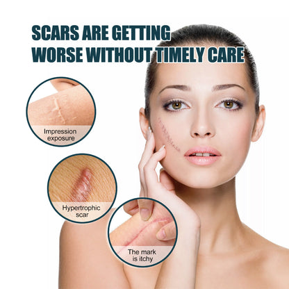 🎉Hot Sale 49% OFF🎉 - Professional Silicone Scar Sheets