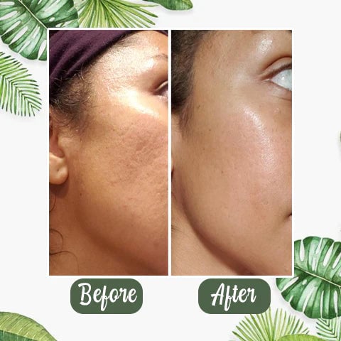 Last Day 49%OFF- ✨Green Tea Deep Cleanse Mask