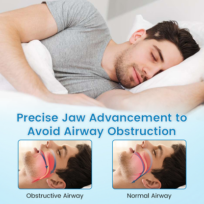 🌙 SILENT NIGHTS, STRONG TEETH! 🦷 QIAWI™ Anti-Snoring Guard 🔵✨