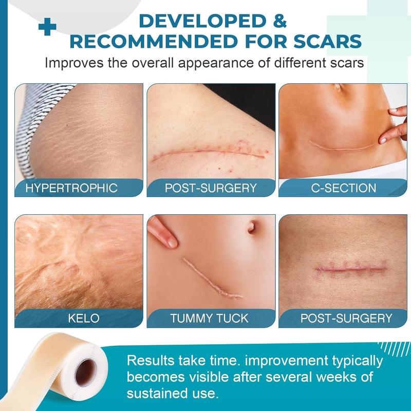 🎉Hot Sale 49% OFF🎉 - Professional Silicone Scar Sheets