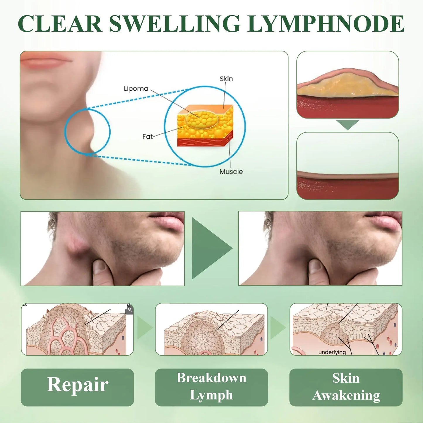 The most popular detoxification choice in 2024: Lymphatic Foot Patch