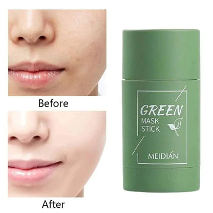 Last Day 49%OFF- ✨Green Tea Deep Cleanse Mask