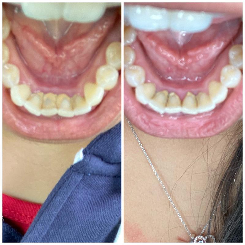 Guru Nanda™️ Coconut Oil Pulling w/ Essential Oils (FREE GIFTS INCLUDED TODAY)