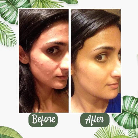 Last Day 49%OFF- ✨Green Tea Deep Cleanse Mask