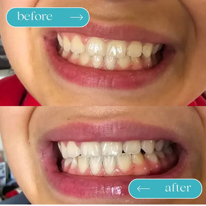 Guru Nanda™️ Coconut Oil Pulling w/ Essential Oils (FREE GIFTS INCLUDED TODAY)